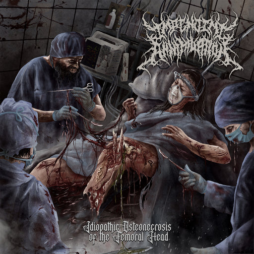 Impending Annihilation - Idiopathic Osteonecrosis of the Femoral Head