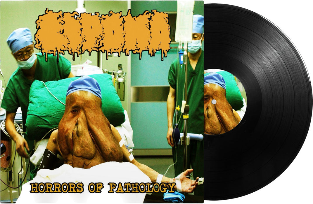 Lipoma - Horrors of Pathology (Vinyl)