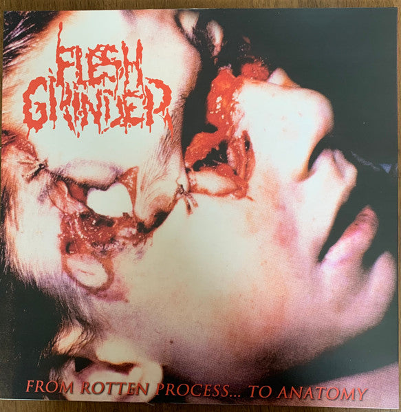 Lymphatic Phlegm / Flesh Grinder – Malignant Cancerous Tumour In The Epithelial Tissue Of The Intestine / From Rotten Process... To Anatomy (Vinyl)