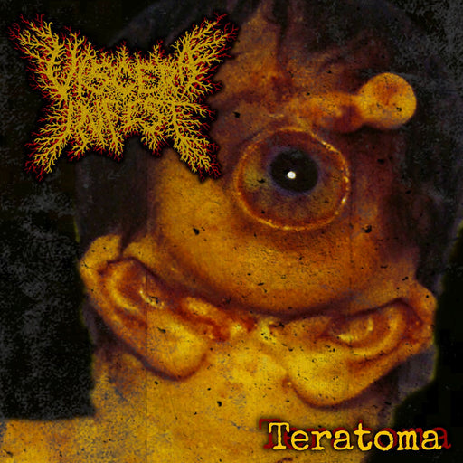 Viscera Infest - Teratoma