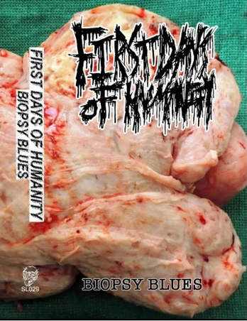 First Days Of Humanity - Biopsy Blues (Cassette)