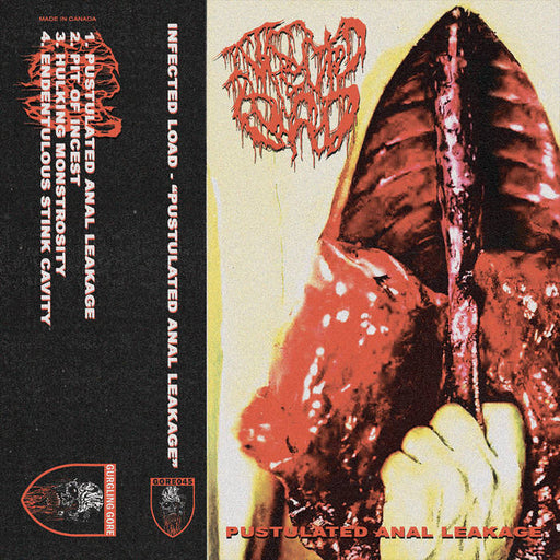 Infected Load - Pustulated Anal Leakage (Cassette)